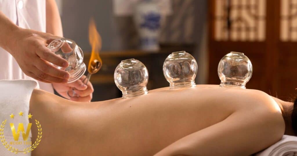 Do you want to try cupping for weight loss?