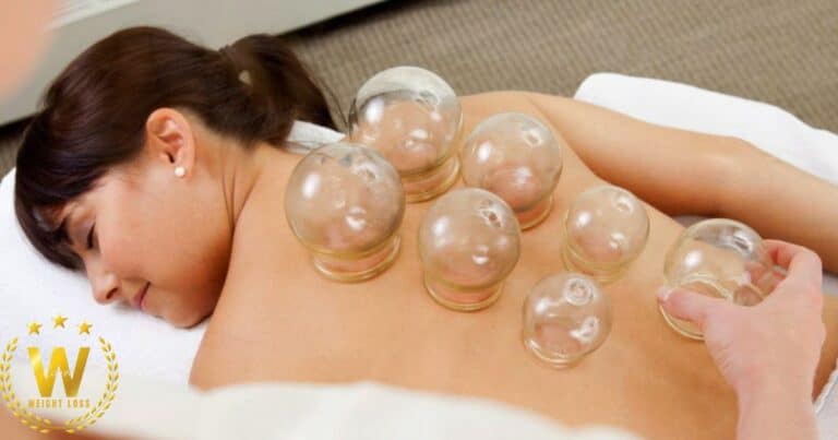 How Often Should You Do Cupping For Weight Loss?