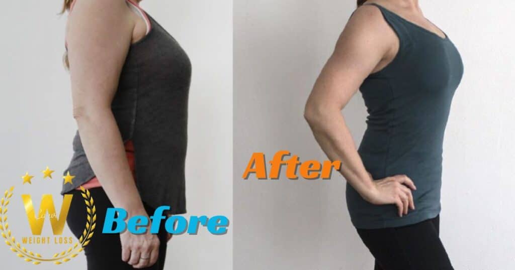 Weight Loss Injections Before And After
