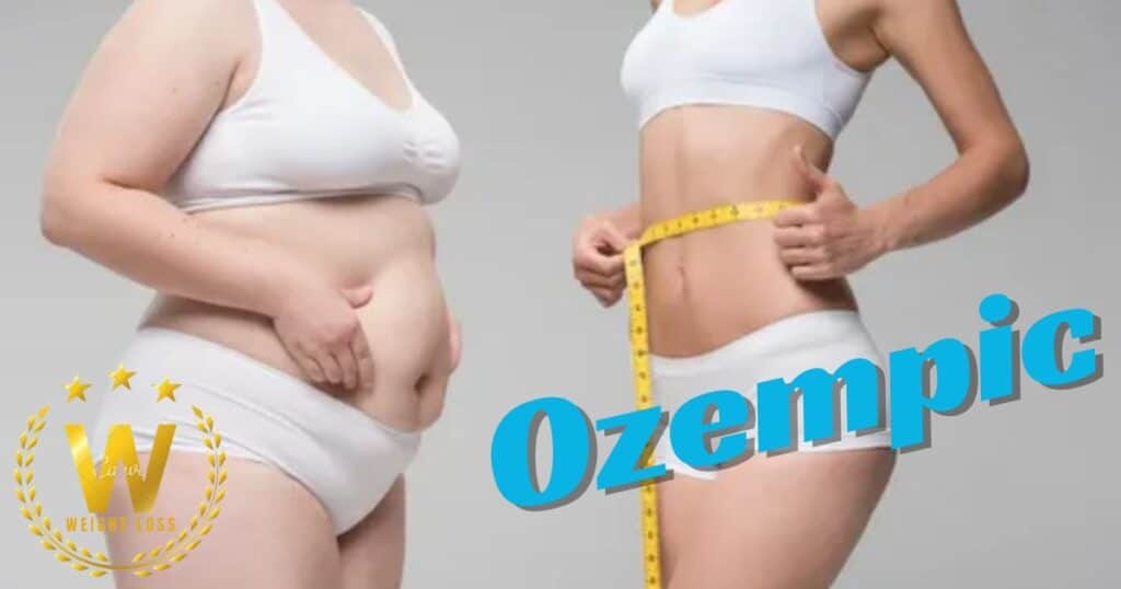 Who Qualifies For Ozempic For Weight Loss?